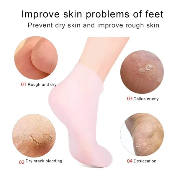 Silicone Jelly Socks for Dry, Cracked Feet – Moisturizing Gel Foot Care Socks